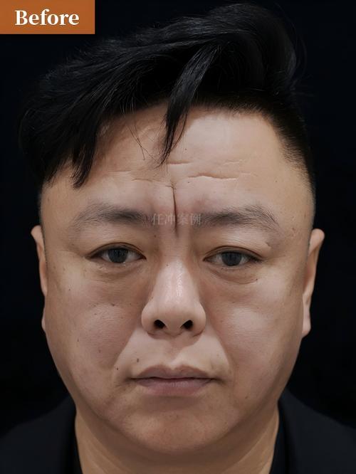 永安24小时在线套医保微信能用吗怎么弄？官方解答来了